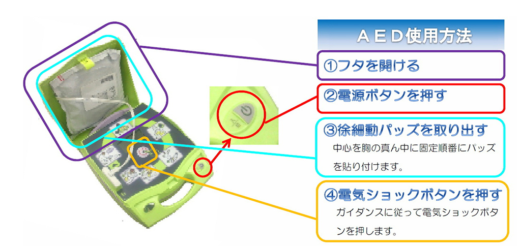 AEDの使用方法 及び 使用